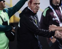 CONCACAF Nations League: allenatore del Messico colpito alla testa